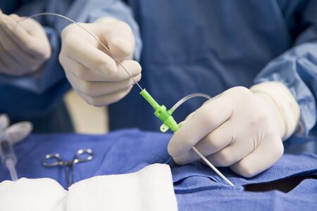 Angiography - Catheterization